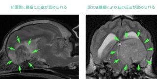 �]��ᇂ�MRI�@���ׂĂ݂���B